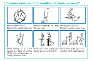 Exercises for Varicose Veins, T S Comprozone India